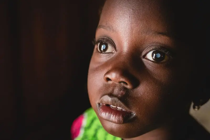 Mossane cataracts patient, at home before surgery.