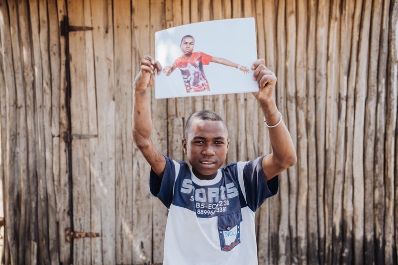 Pierre, plastics patient, holding his "before" photos.