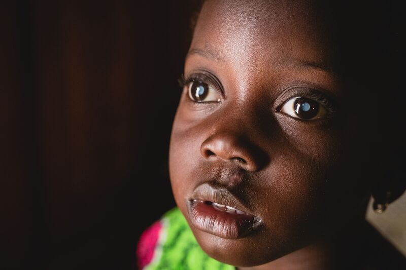 Mossane cataracts patient, at home before surgery.