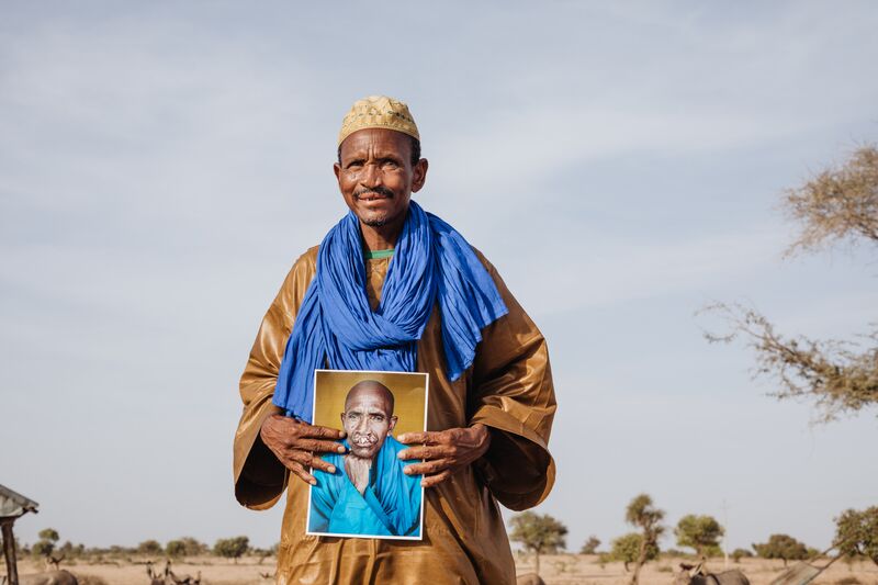 Samba, cleft lip patient, holds his before portrait at his village located in Gatty Nggaraf in the Tiovaoune distrct of Senegal during a home visit.